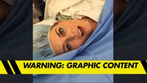 Lindsey Vonn-- Ski-Daddles to Hospital After Nasty Dog Bite
