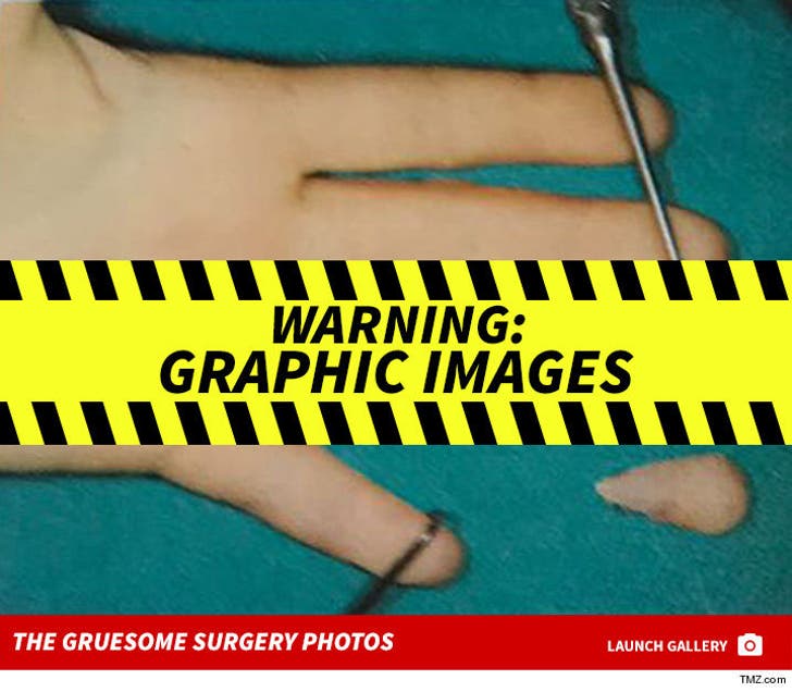 Lindsay Lohan's Graphic Finger Surgery