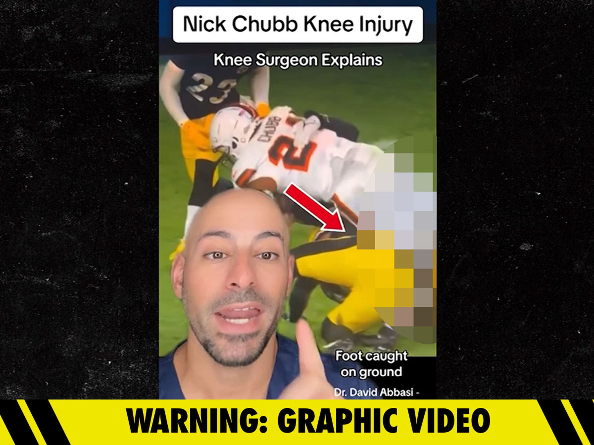 nick chubb injury steelers replay｜TikTok Search