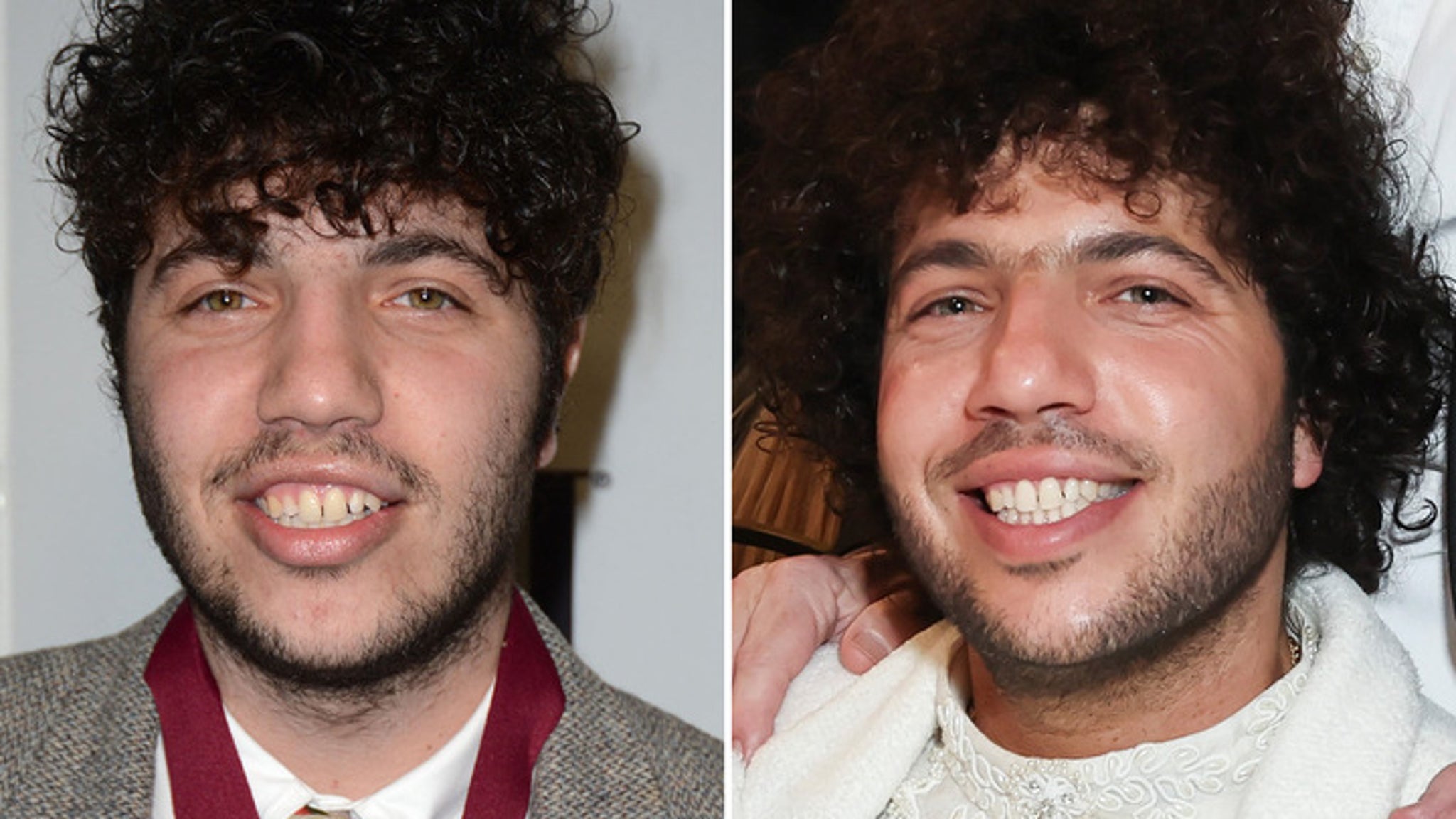 Benny Blanco -- Good Genes or Good Docs?!