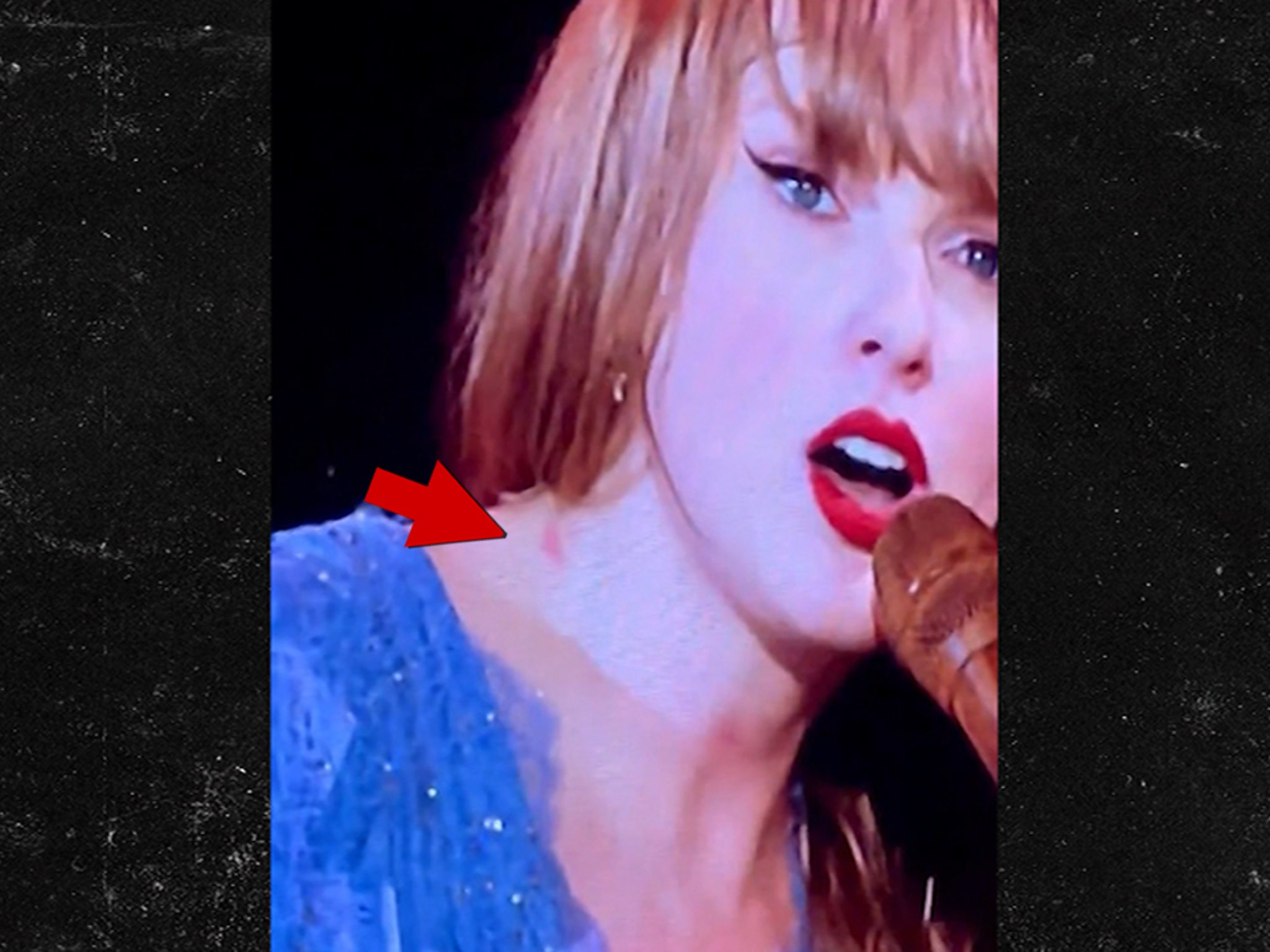 Taylor Swift Appears to Have a Hickey in Sweden, After Travis Kelce Getaway