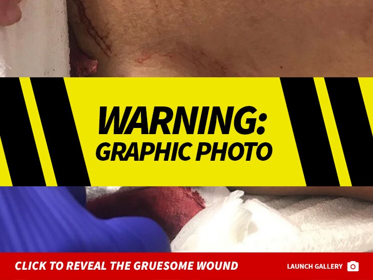 Miles Hurley's Gruesome Stab Wound