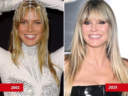 1101-heidi-klum-good-genes-good-docs-primary_720
