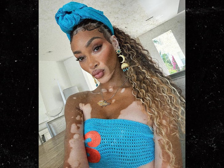 0717-Winnie-Harlow-Hot-Shot-SUB-1