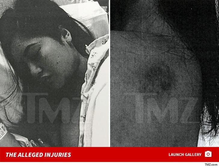 Trey Songz -- The Alleged Injuries