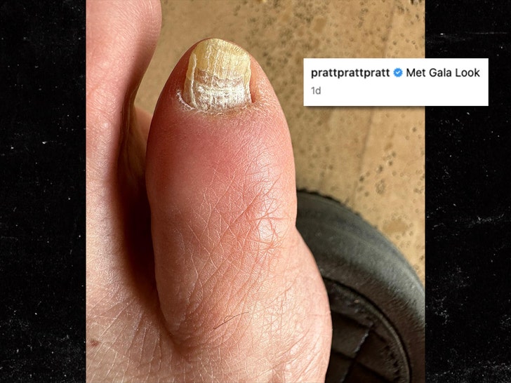 chris pratt toe insta