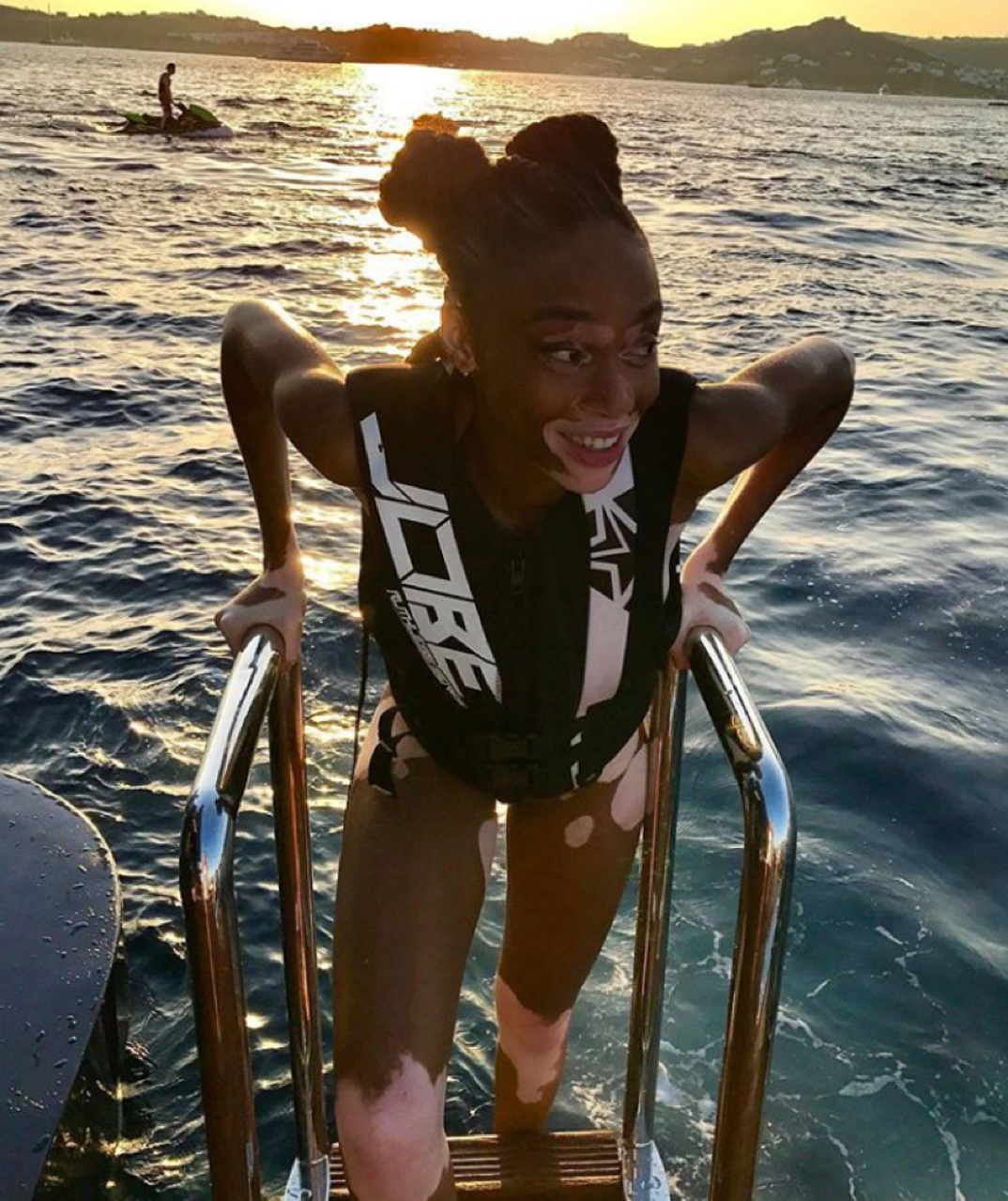 Winnie Harlow