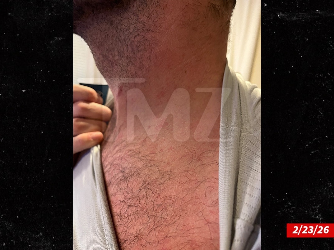 Dakota-Mortensen-Alleged-Injuries-Swipe- 0