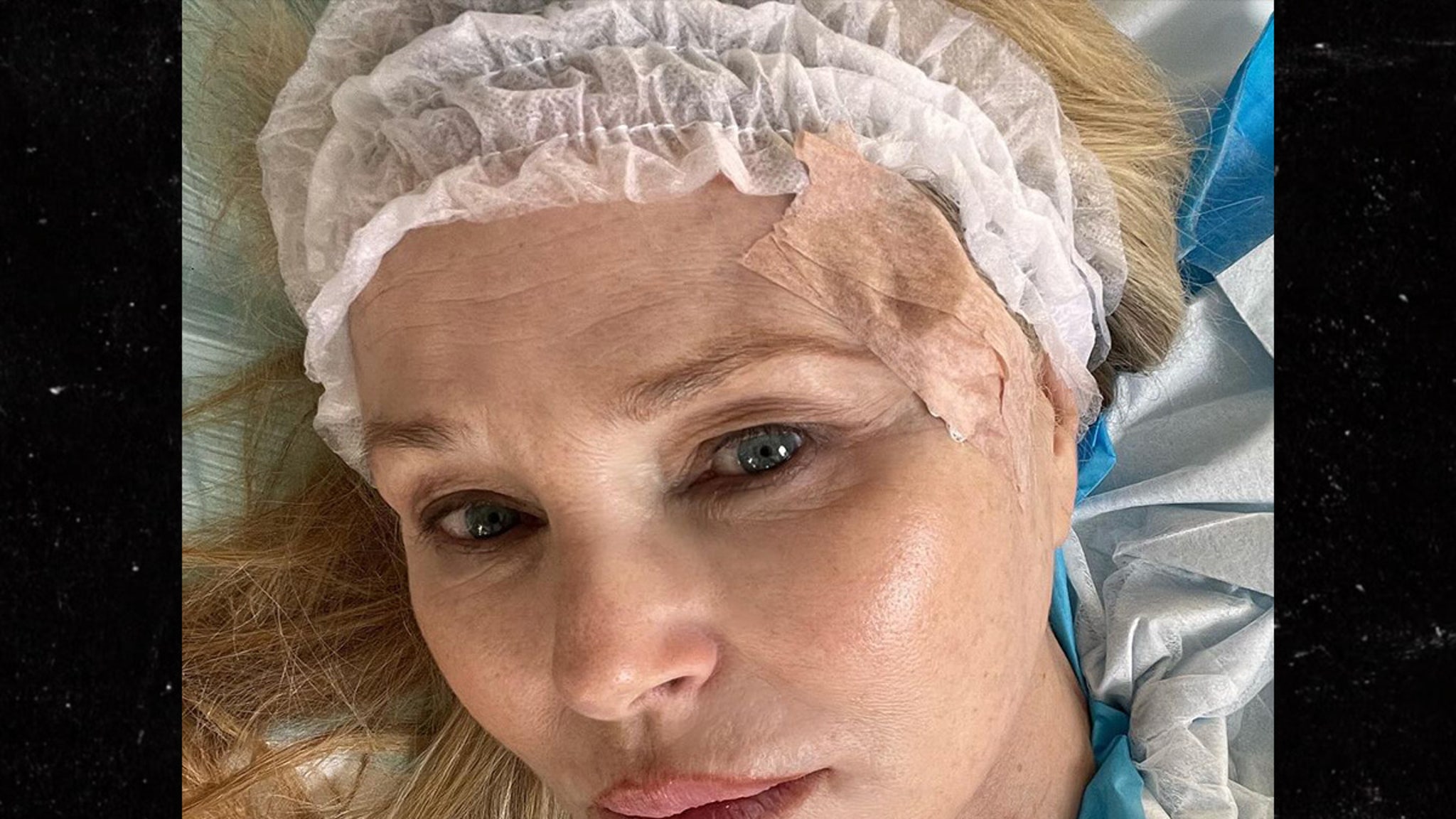 Christie Brinkley ujawnia diagnozę raka skóry i udostępnia zdjęcia z operacji