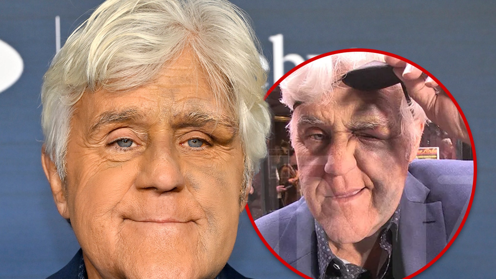 Jay Leno Looking Better After Nasty Fall Did Serious Damage to His Face