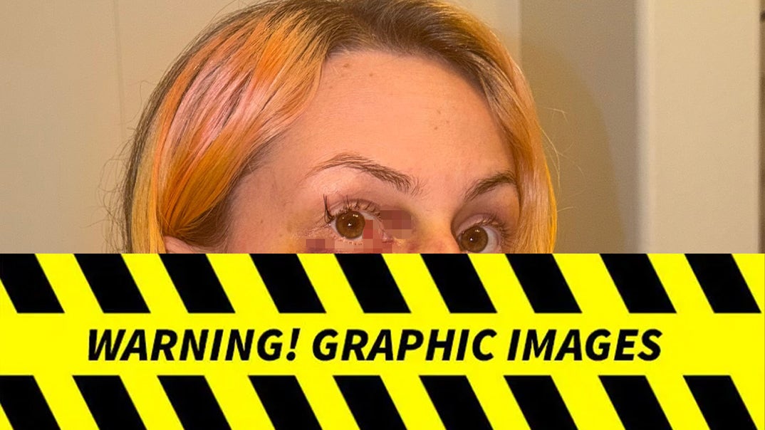 0827-Pam-Rodriguez-Alleged-Injury-Photos-PRIMARY