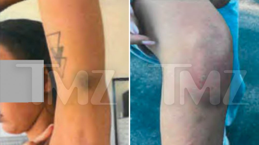 1014-Maria-Lafuente-Injuries-PRIMARY