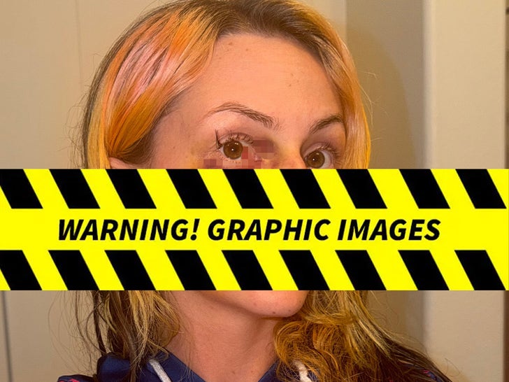 Pam Rodriguez Alleged Injury Photos