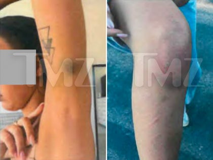 1014-Maria-Lafuente-Injuries-PRIMARY
