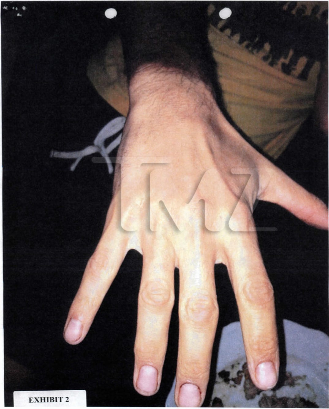 gabriel_aubry_fight_injuries_07