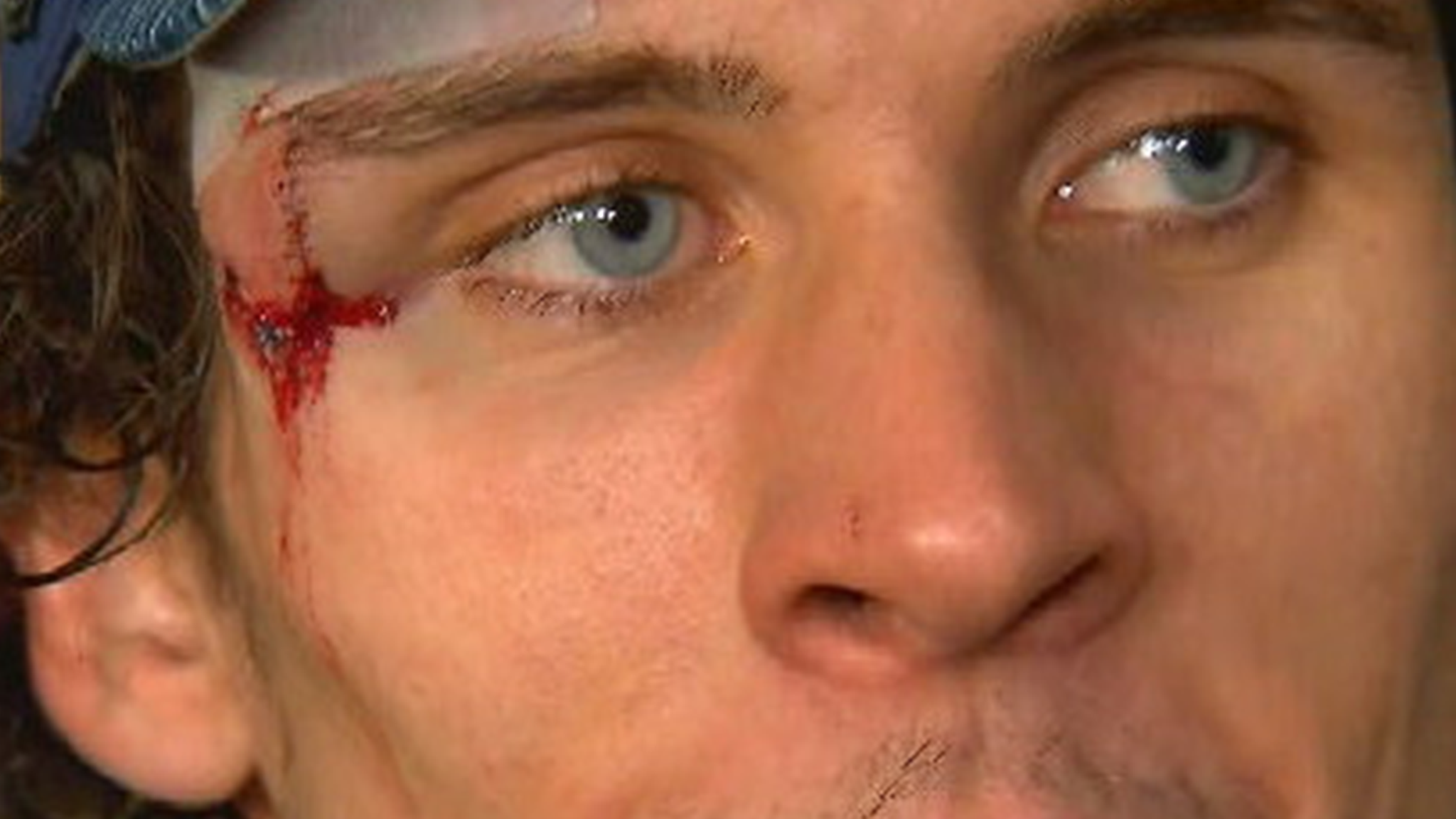 A Stanley Cup Champ Is Auctioning His Facial Stitches for Charity