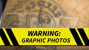 Suge Knight -- 6 Bullet Holes & Huge Surgery Scar (PHOTOS)