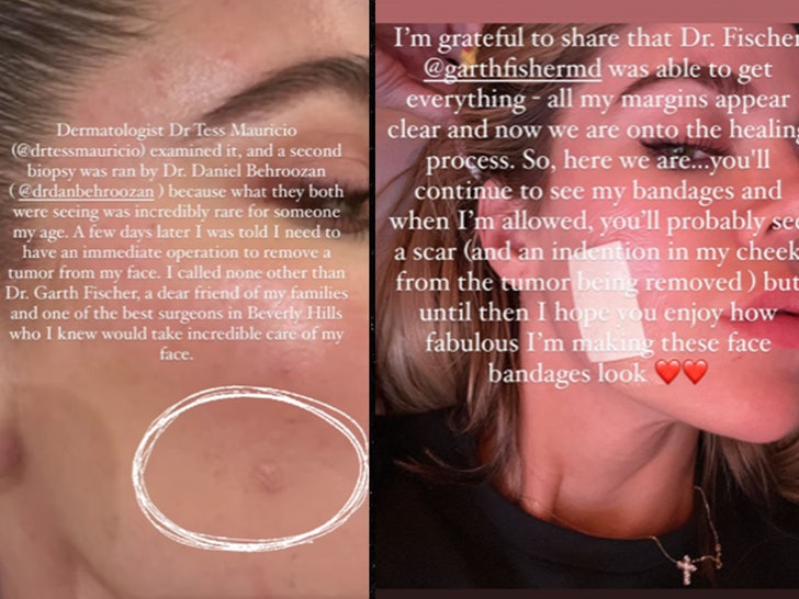 Kollegium Breddegrad bekvemmelighed Khloe Kardashian Reveals Skin Cancer Scare, Tumor Removed from Face