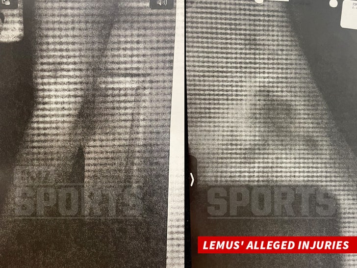 Lemus' Alleged Injuries