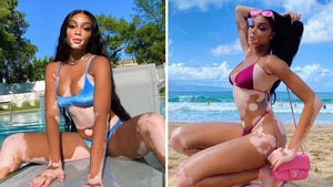 Winnie Harlow Hot Shots