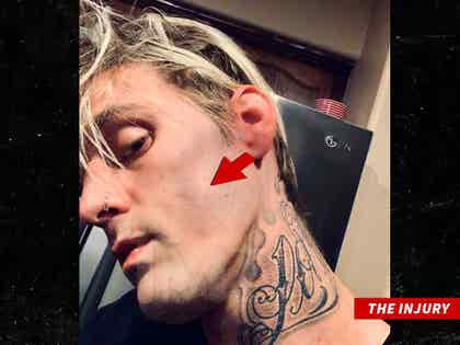 0809 aaron carter injury tmz wm