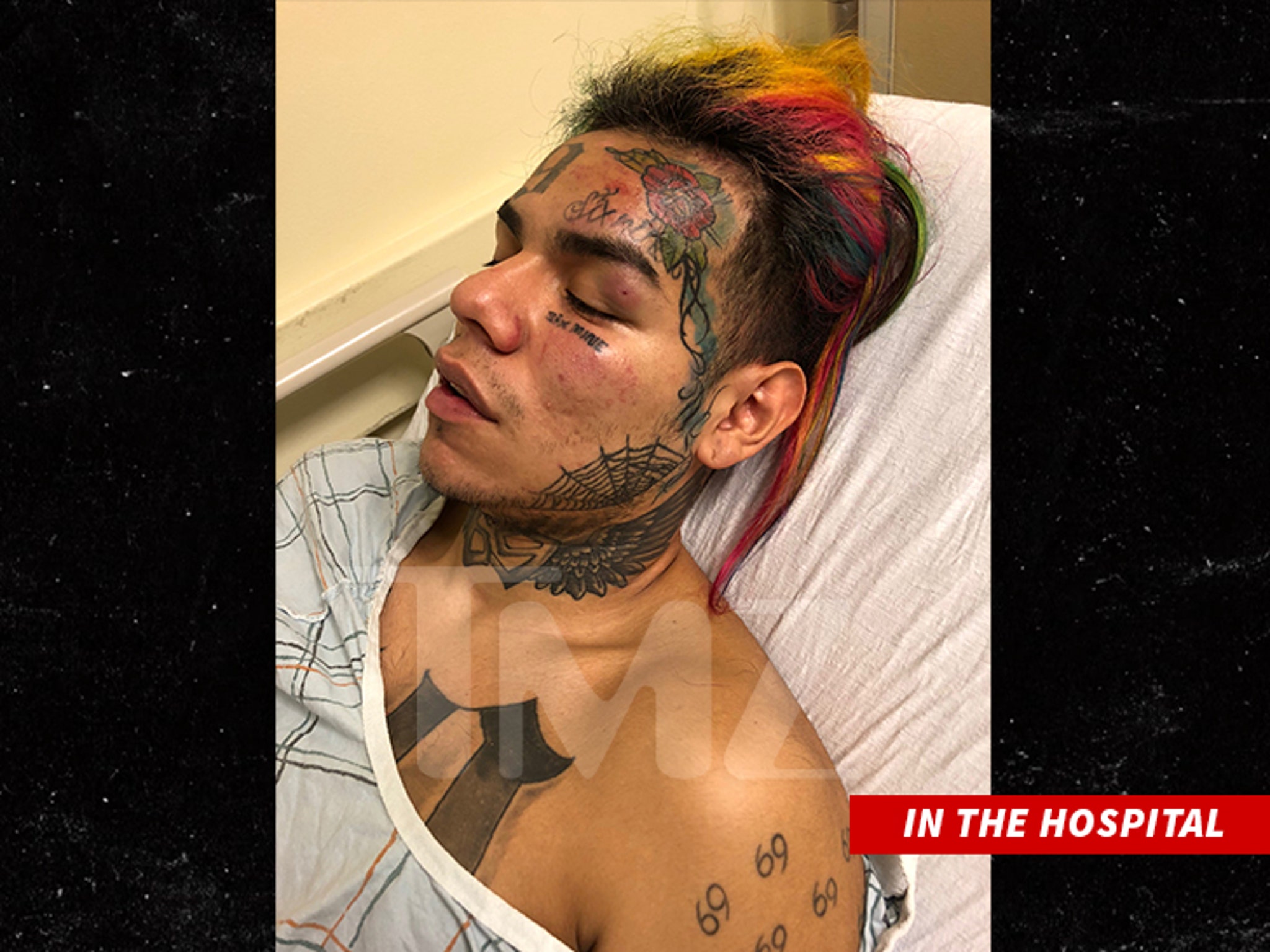 Tekashi69 Pistol Whipped Kidnapped Robbed And Hospitalized Update