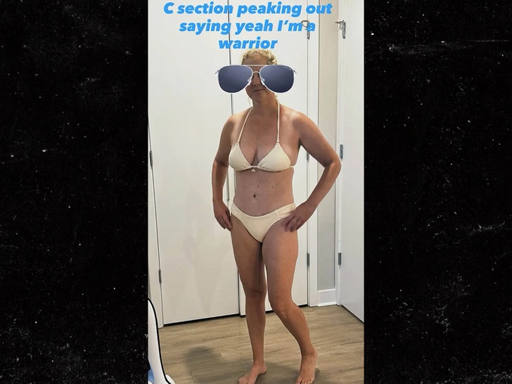 sub-Amy-Schumer-ig-1