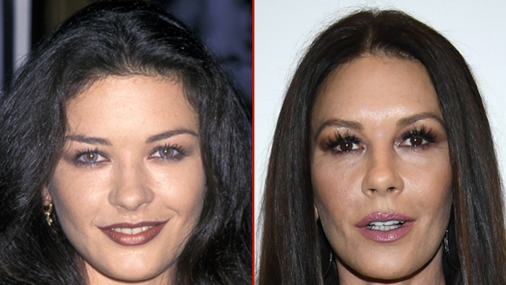 Catherine zeta jones plastic surgery photos