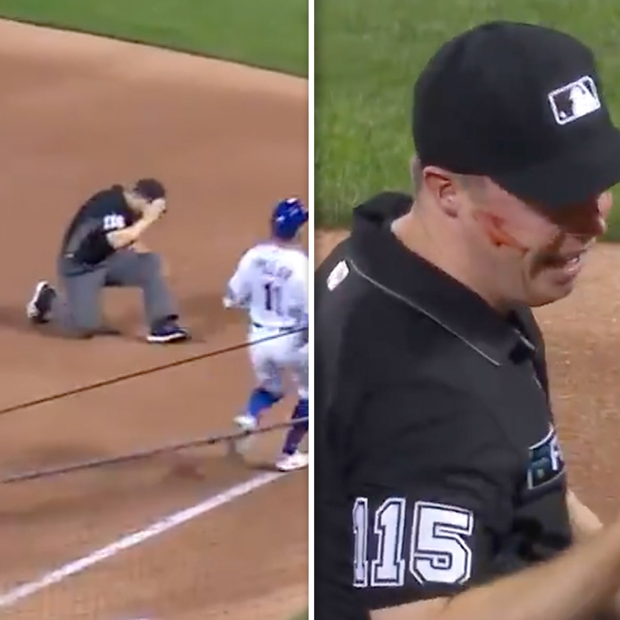 Video: MLB Ump Hit in Face by Wild Throw During Cardinals-Mets Game