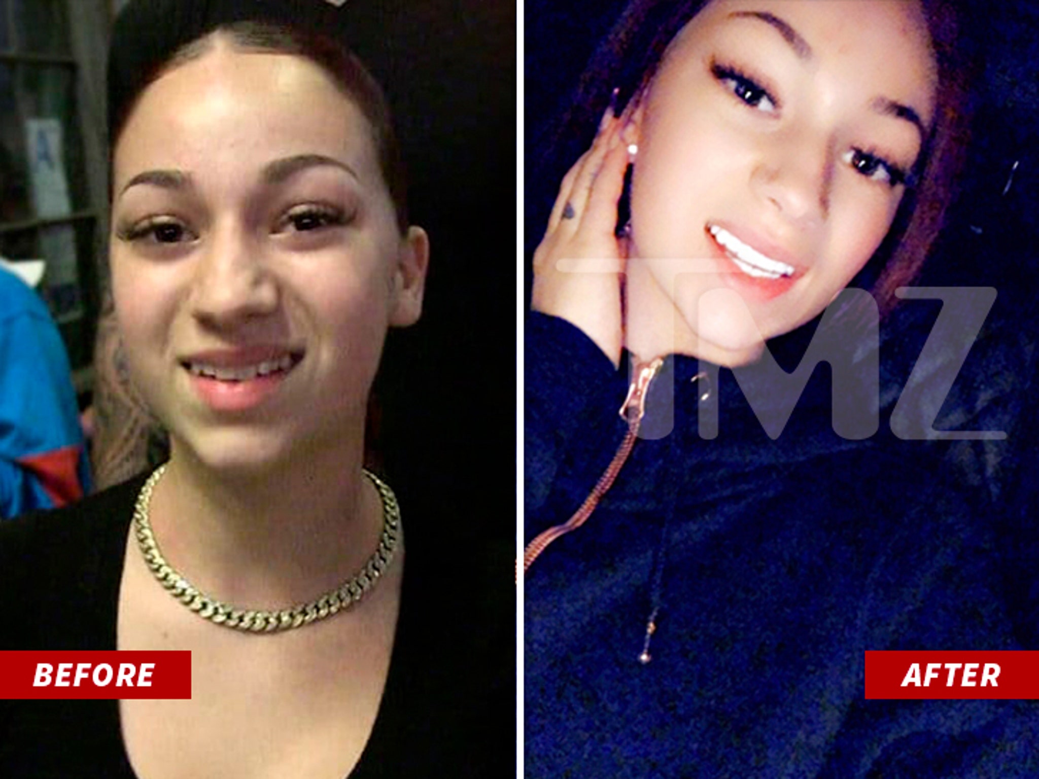 Bhad Bhabie Before & After Plastic Surgery Photos - 0zovsm2