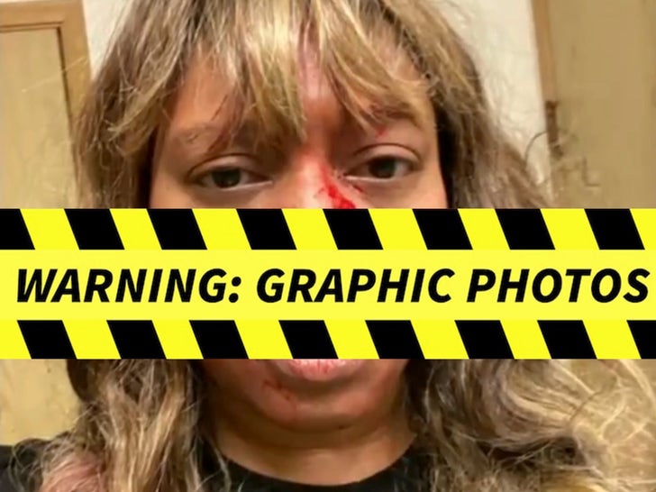Alleah Taylor Injuries — Graphic Photos