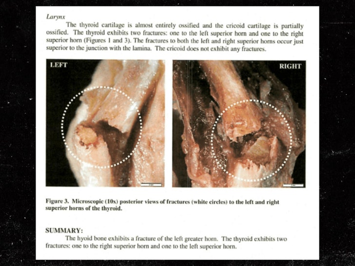Fotos de la investigación de la muerte de Jeffrey Epstein Sub 4