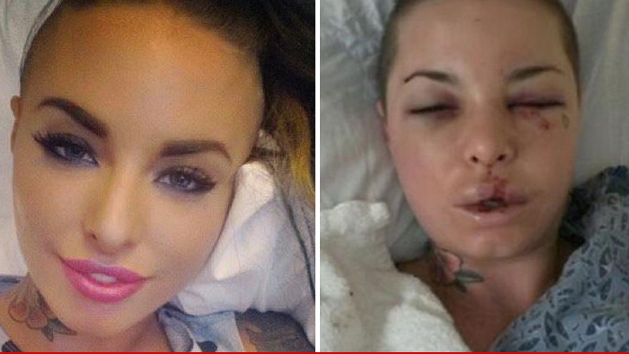 Christy Mack's face showing the aftermath of a brutal attack a somber reminder