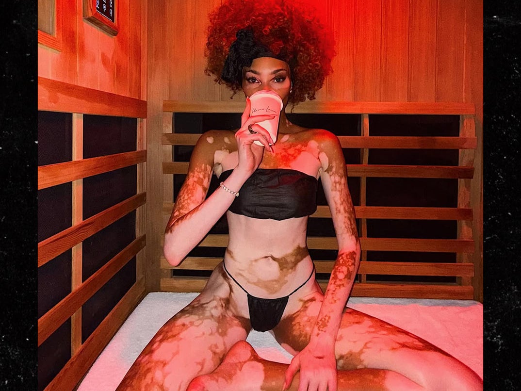 Winnie Harlow