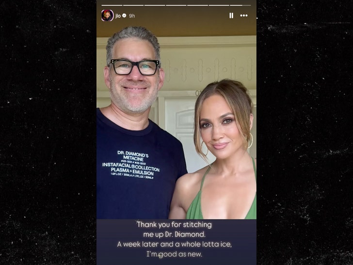 Jennifer Lopez ama rehearsal injury Insta 2