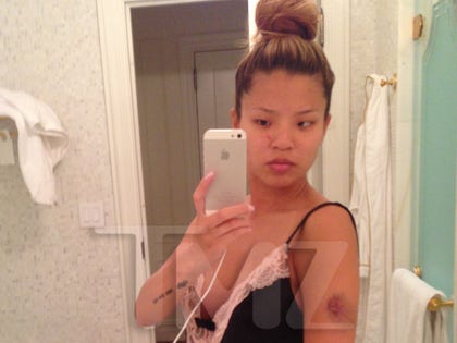 lydia_nam_the_dream_pregnant_injury_photos_016