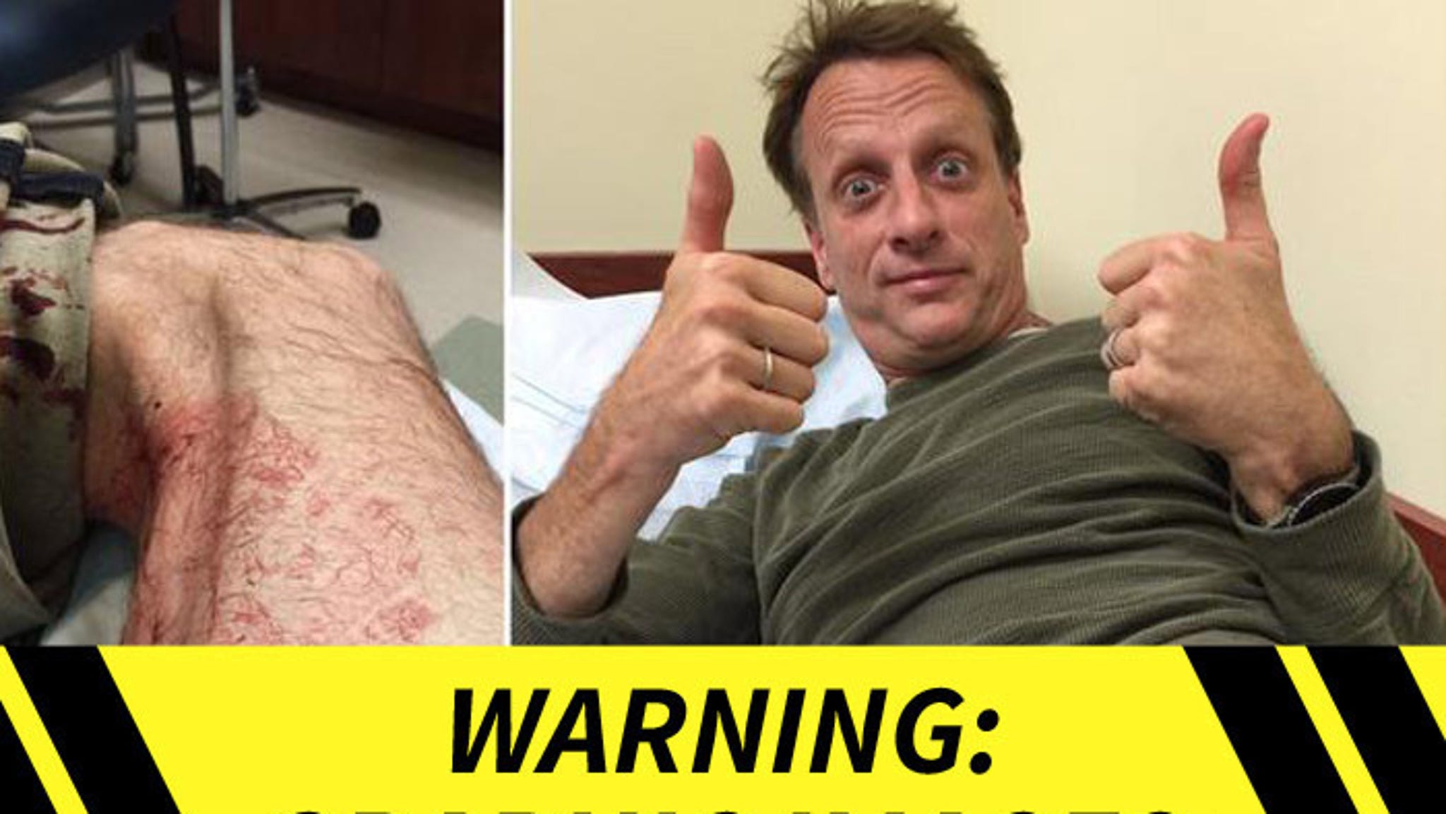 Tony Hawk GNARLY LEG INJURY During Skate Accident