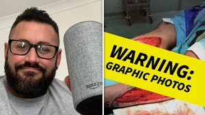 UK Bodybuilder Nearly Loses Legs In Gnarly Staircase Fall, My Alexa Saved Me!