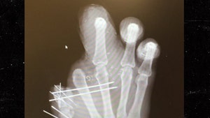 Jason Pierre-Paul -- Reveals Mangled X-Ray ... No Bones? No Problem! (PHOTO)