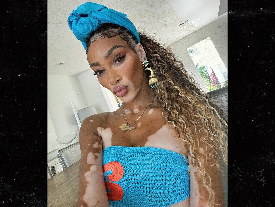 0717-Winnie-Harlow-Hot-Shot-SUB-1