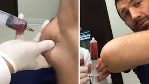 UFC's Luke Rockhold -- Disgusting Elbow Draining Video ... Is Kinda Awesome