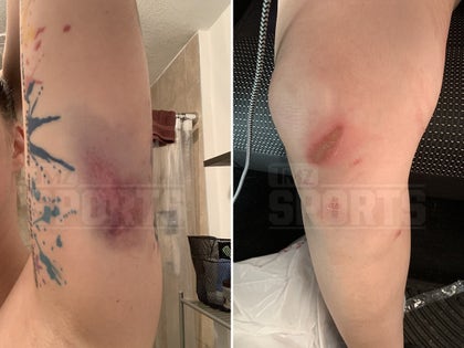 1118-zac-stacy-victim-alleged-injuries-photos-primary