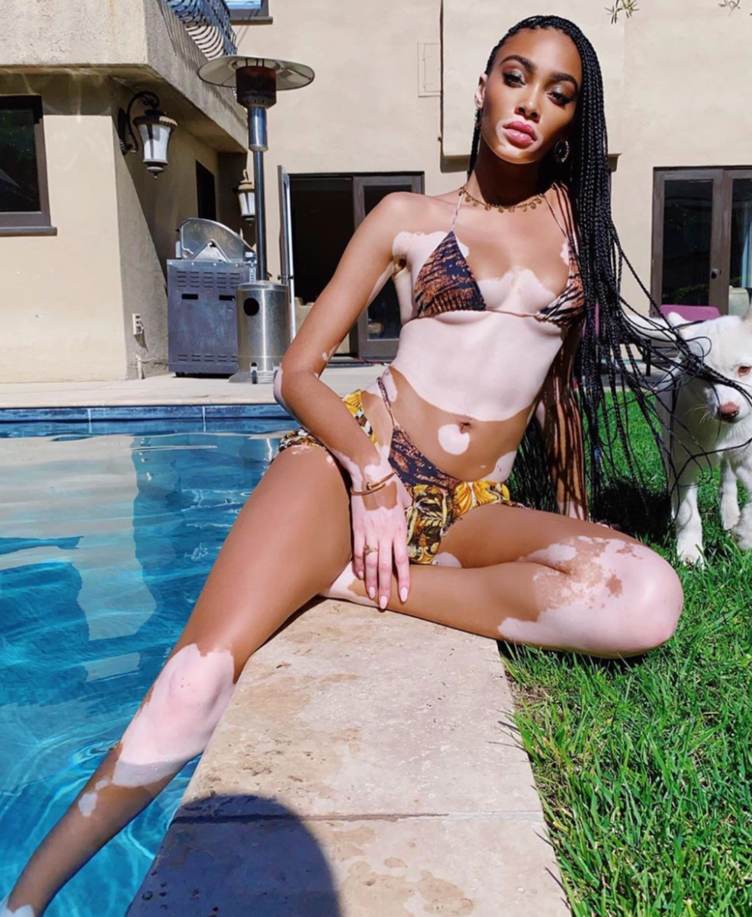 winnie harlow hot Shots 4