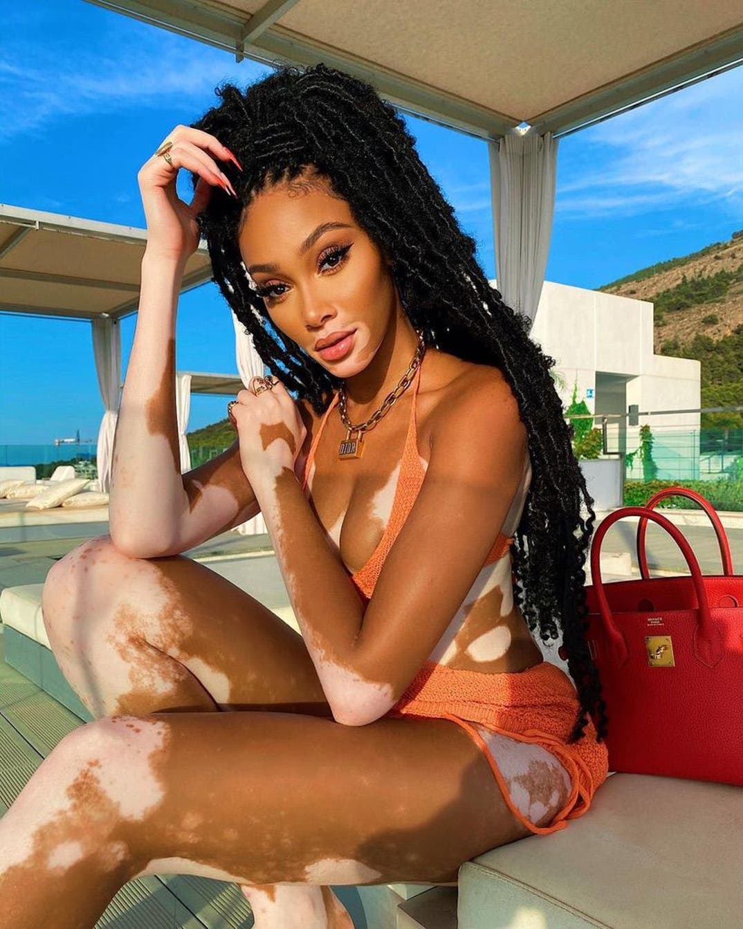 0726 Winnie Harlow Hot Shots 2