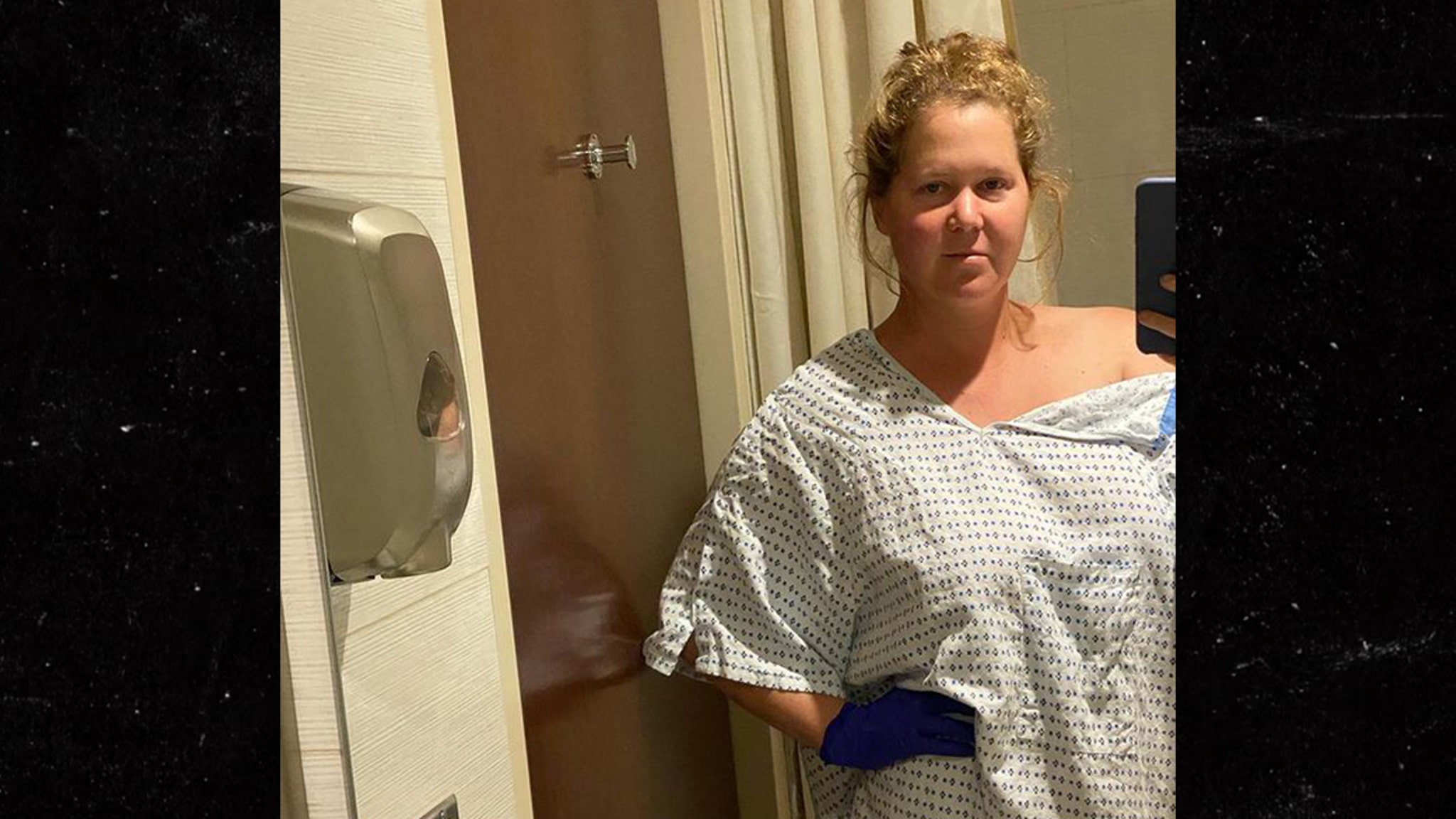 Amy Schumer Has Uterus And Appendix Removed From Endometriosis Trueviralnews