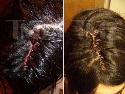 0414-tyga-head-injuries-lawsuit-TMZ-01