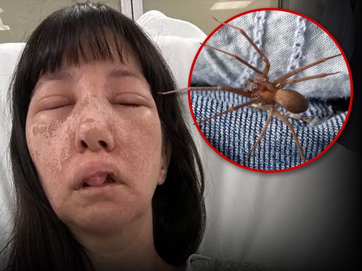 brown recluse spider bite woman