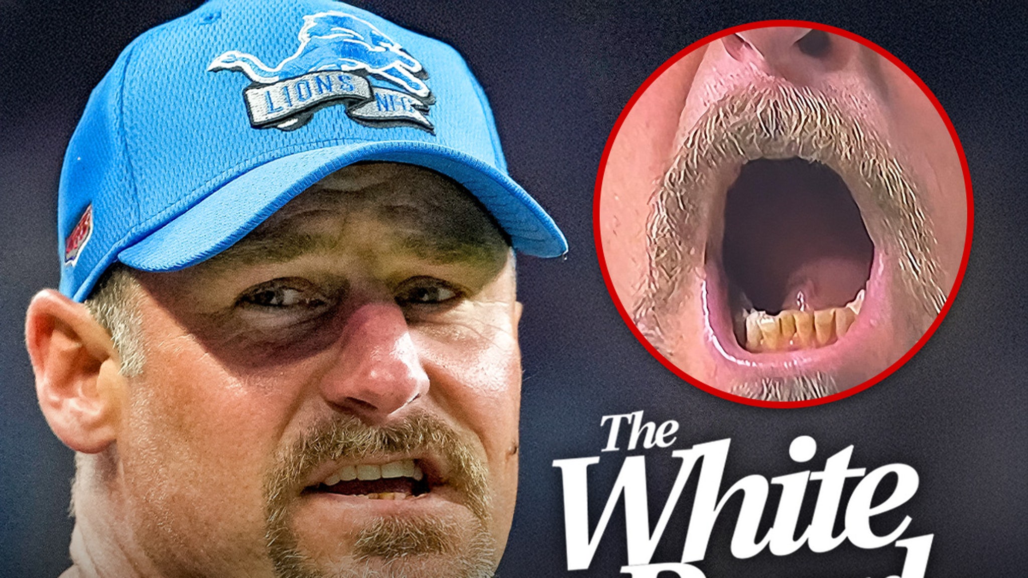 Dan Campbell Offered Lifetime Supply of Teeth-Whitening Product