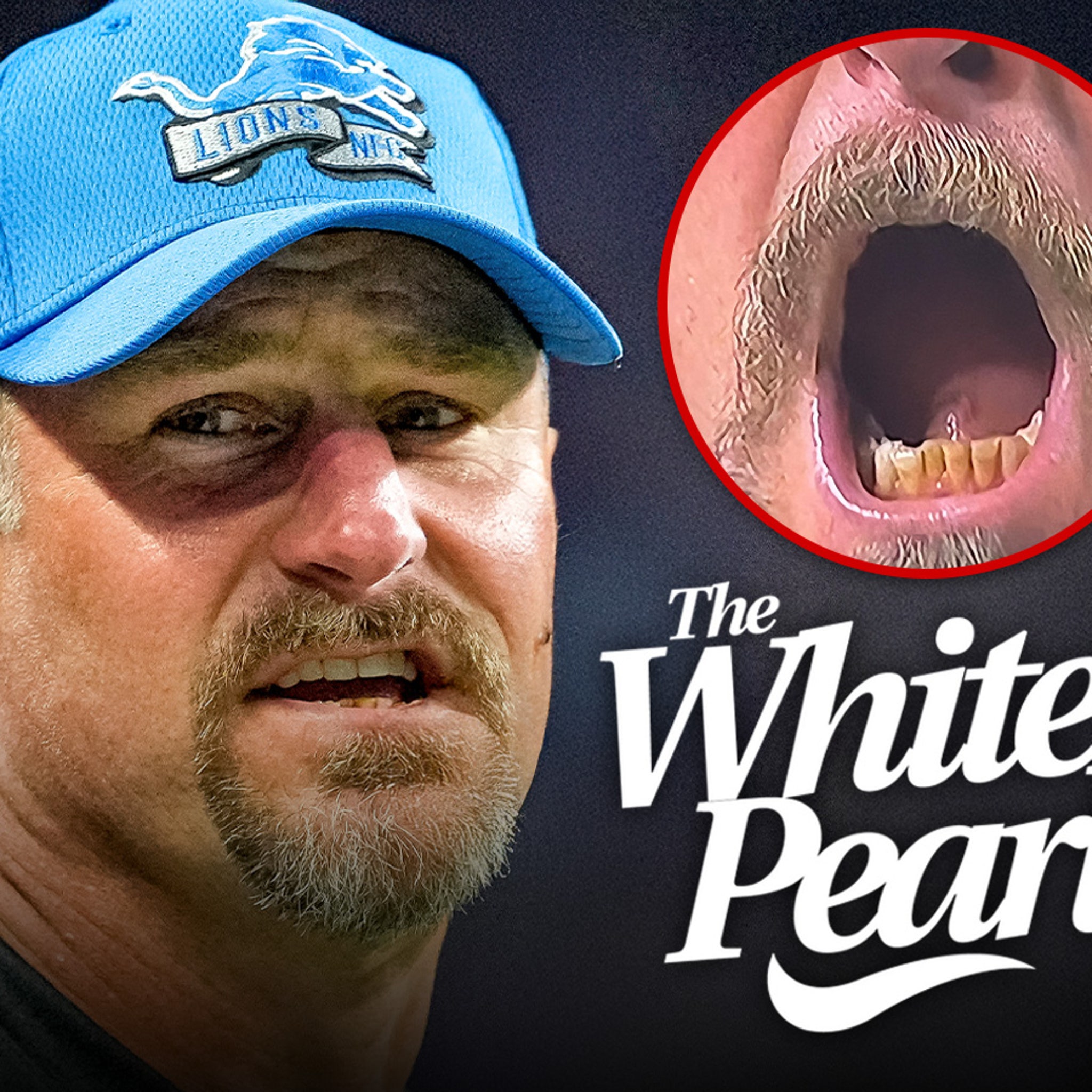 Dan Campbell Offered Lifetime Supply of Teeth-Whitening Product