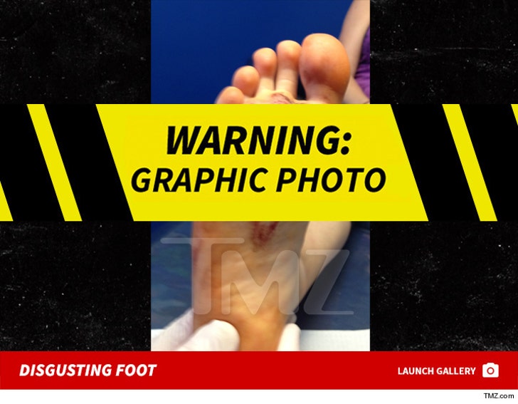 Disgusting foot